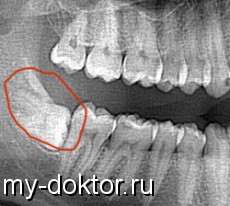        - MY-DOKTOR.RU