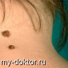   . 2   (-) - MY-DOKTOR.RU