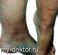  - MY-DOKTOR.RU