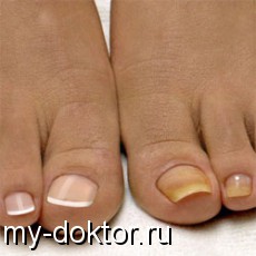   .      - MY-DOKTOR.RU