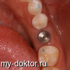    ? - MY-DOKTOR.RU