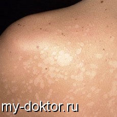      ? - MY-DOKTOR.RU