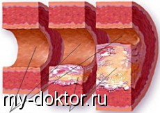    ?    ? - MY-DOKTOR.RU