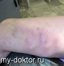      - MY-DOKTOR.RU