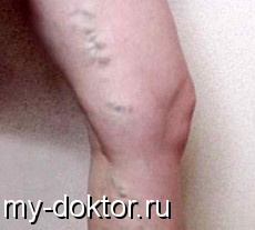   . , ,  - MY-DOKTOR.RU