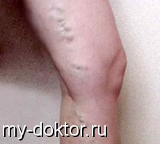            - MY-DOKTOR.RU