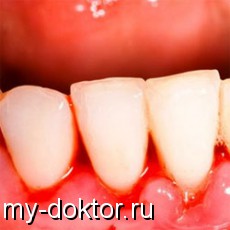    ! (, ,  ) - MY-DOKTOR.RU