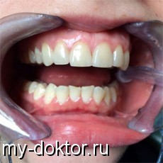       - MY-DOKTOR.RU