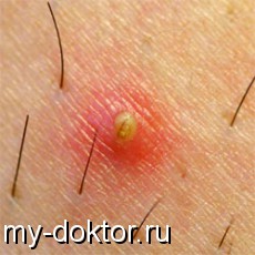    .        - MY-DOKTOR.RU