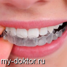    invisalign - MY-DOKTOR.RU