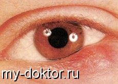   ,  .    - MY-DOKTOR.RU