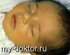   .    - MY-DOKTOR.RU