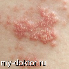      (   ) - MY-DOKTOR.RU