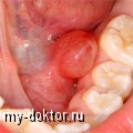    - MY-DOKTOR.RU