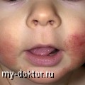      ! - MY-DOKTOR.RU