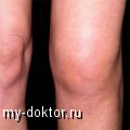   - MY-DOKTOR.RU