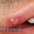        ? - MY-DOKTOR.RU