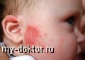    ?  - MY-DOKTOR.RU