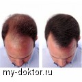 Эффективные средства от выпадения волос - MY-DOKTOR.RU