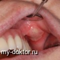  . . . .  - MY-DOKTOR.RU