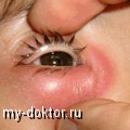    - MY-DOKTOR.RU