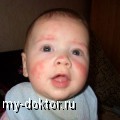     - MY-DOKTOR.RU