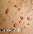   !        - MY-DOKTOR.RU