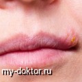 . . . .  - MY-DOKTOR.RU