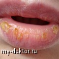     ? - MY-DOKTOR.RU