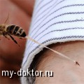 Как лечить укусы пчёл и ос - MY-DOKTOR.RU