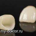 Керамические коронки на зубы: особенности и преимущества - MY-DOKTOR.RU