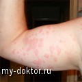    ,    (-) - MY-DOKTOR.RU