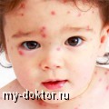 , , ,  - MY-DOKTOR.RU