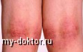     - MY-DOKTOR.RU