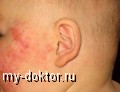    - MY-DOKTOR.RU