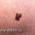  :  ,  . , ,   - MY-DOKTOR.RU