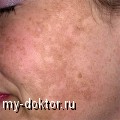 : , , ,  - MY-DOKTOR.RU