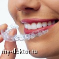 Метод домашнего отбеливания зубов с помощью каппы - MY-DOKTOR.RU