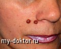       - MY-DOKTOR.RU