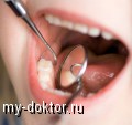 Мифы о кариесе - MY-DOKTOR.RU