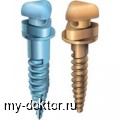 Микроимпланты VectorTAS в ортодонтии - MY-DOKTOR.RU