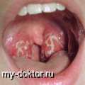 . . . .  - MY-DOKTOR.RU