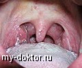    - MY-DOKTOR.RU