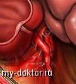     ? - MY-DOKTOR.RU