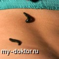    - MY-DOKTOR.RU