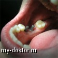      ? - MY-DOKTOR.RU