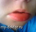   - MY-DOKTOR.RU