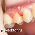 : , , ,   - MY-DOKTOR.RU