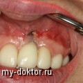 :  , ,  ,  - MY-DOKTOR.RU