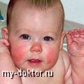   - MY-DOKTOR.RU